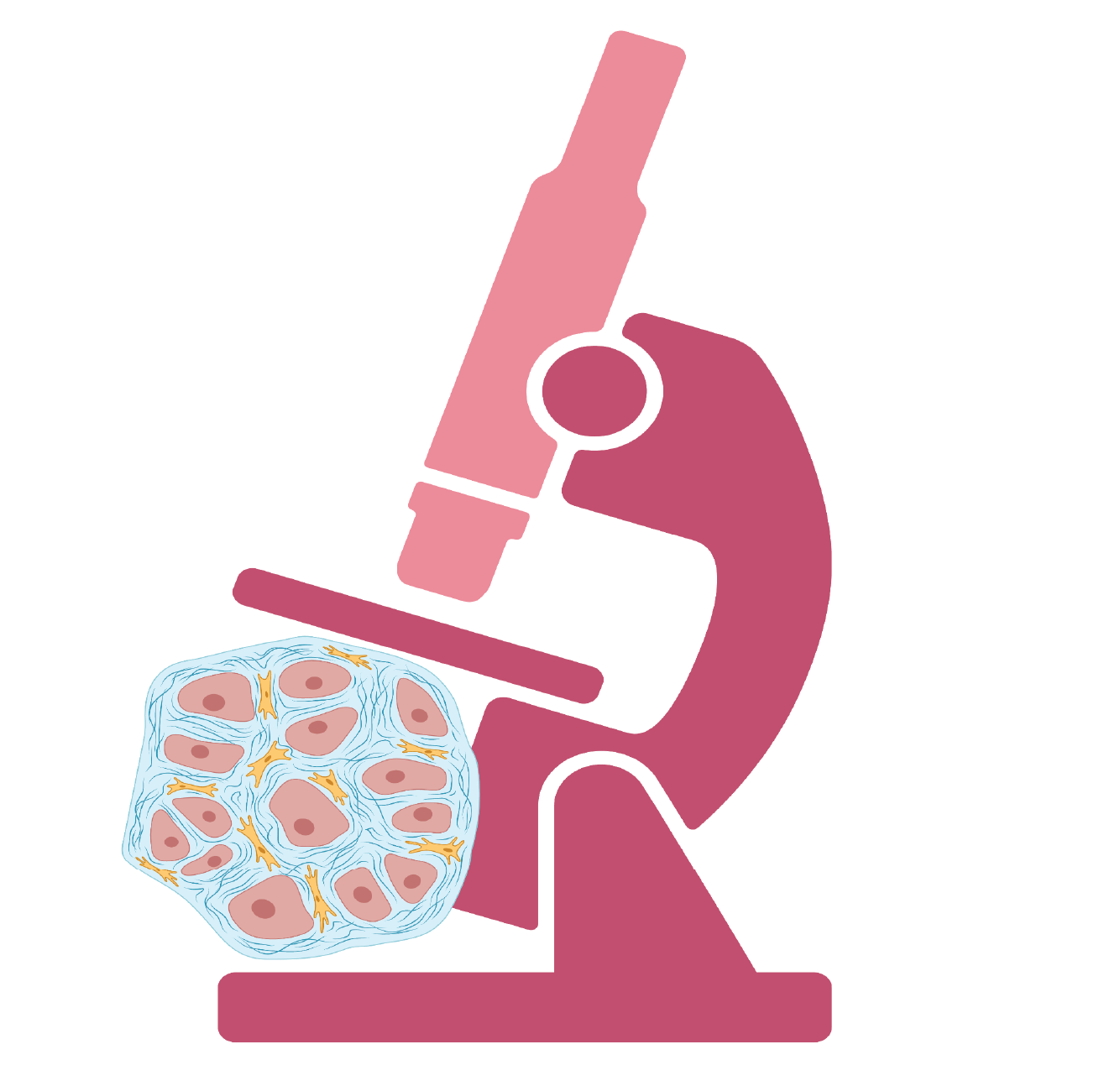 Cancer staging - An image depicting the icon used for analyzing stage-related alternative polyadenylation (IpA) events in cancer patients and their association with disease progression and treatment outcomes