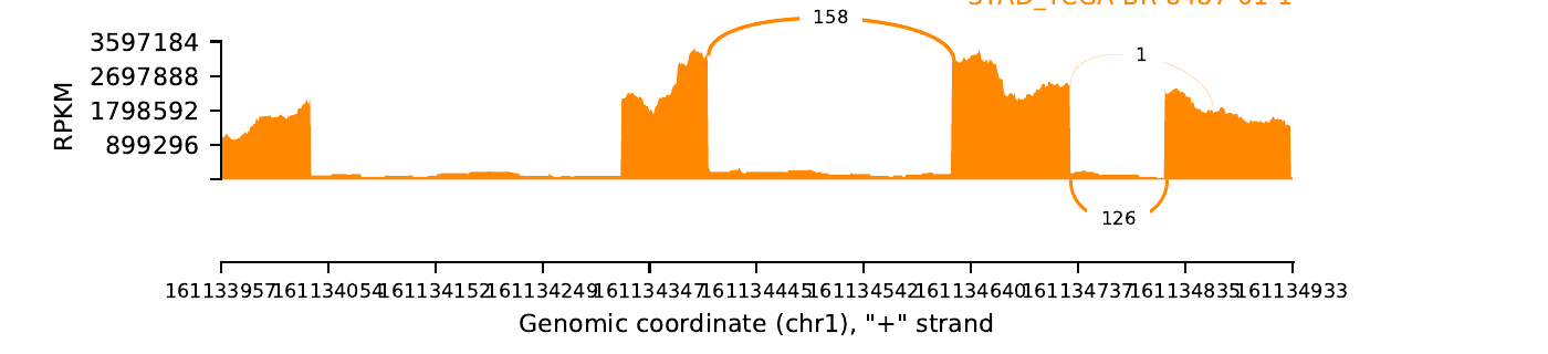 ExonSkipDB: Functional Annotation Of Exon Skipping Event In Human - Search