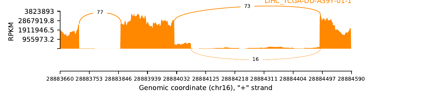 boxplot