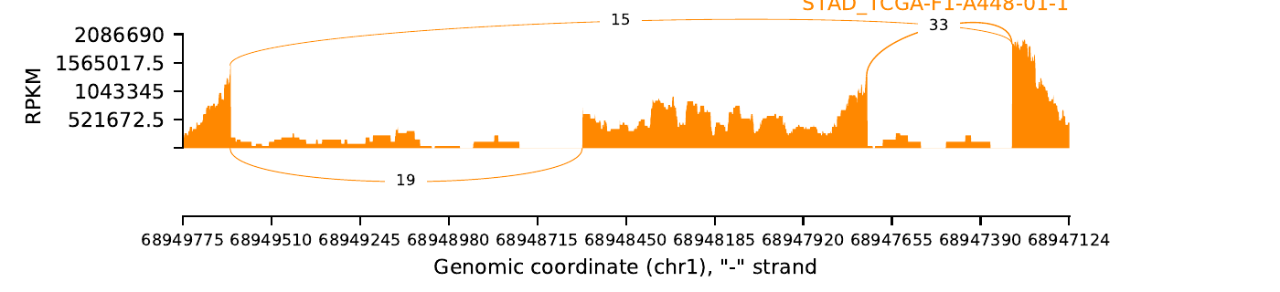 boxplot