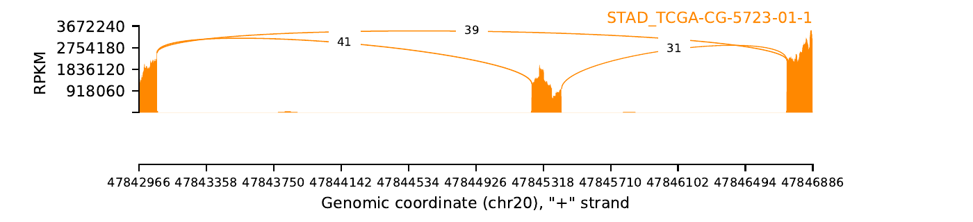 boxplot