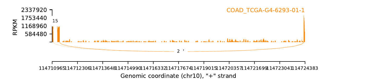 boxplot
